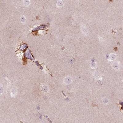 Immunohistochemistry-Paraffin: Kv6.2 Antibody [NBP2-14141]