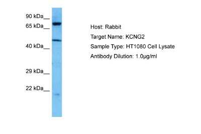 Western Blot: Kv6.2 Antibody [NBP2-83133]