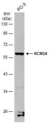 Western Blot: Kv6.4 Antibody [NBP2-17028]