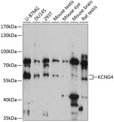 Western Blot: Kv6.4 AntibodyAzide and BSA Free [NBP3-03364]