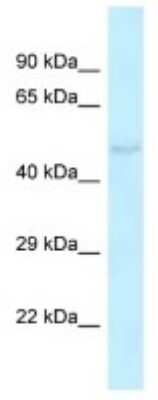 Western Blot: Kv6.4 Antibody [NBP3-10369]