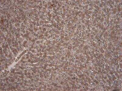Immunohistochemistry: Kv7.1 Antibody [NBP1-30119]