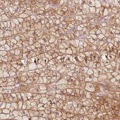 Immunohistochemistry-Paraffin: Kv7.1 Antibody [NBP2-31876]