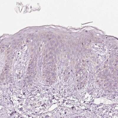 Immunohistochemistry-Paraffin: Kv7.1 Antibody [NBP2-31876]