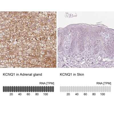 Immunohistochemistry-Paraffin: Kv7.1 Antibody [NBP2-31876]
