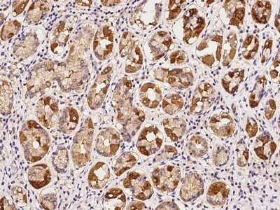 Immunohistochemistry-Paraffin: Kv7.1 Antibody [NBP2-97900]