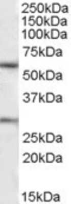 Western Blot: Kv7.1 Antibody [NBP1-30119]