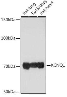 Western Blot: Kv7.1 AntibodyBSA Free [NBP3-03610]