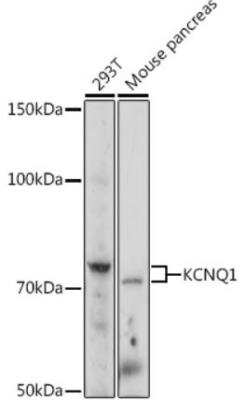 Western Blot: Kv7.1 AntibodyBSA Free [NBP3-03610]