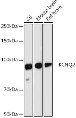 Western Blot: Kv7.2 AntibodyAzide and BSA Free [NBP3-03616]