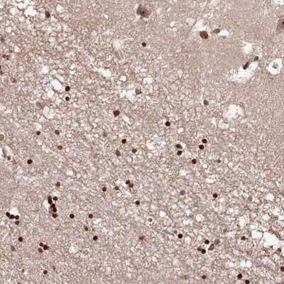Immunohistochemistry: Kv7.2 Antibody [NBP2-38820]