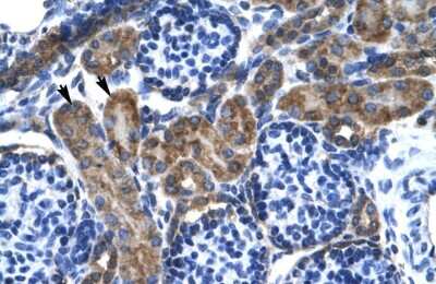 Immunohistochemistry: Kv7.2 Antibody [NBP2-85193]