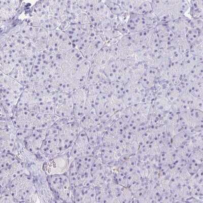 Immunohistochemistry-Paraffin: Kv7.2 Antibody [NBP2-38820]
