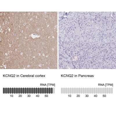 Immunohistochemistry-Paraffin: Kv7.2 Antibody [NBP2-38820]