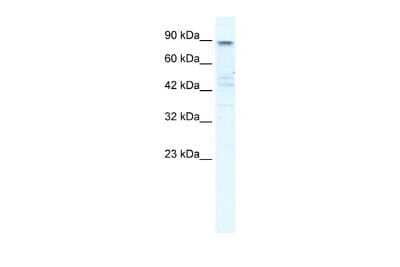 Western Blot: Kv7.2 Antibody [NBP2-85190]