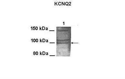 Western Blot: Kv7.2 Antibody [NBP2-85192]