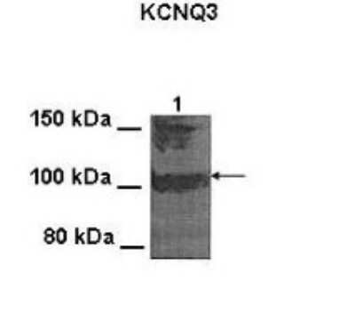 Western Blot: Kv7.3 Antibody [NBP1-74102]