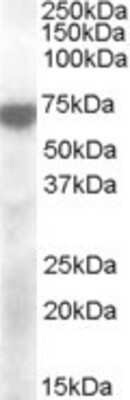 Western Blot: Kv7.4 Antibody [NB100-93448]