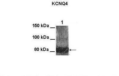 Western Blot: Kv7.4 Antibody [NBP2-82272]