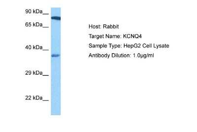 Western Blot: Kv7.4 Antibody [NBP2-82273]