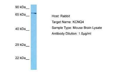 Western Blot: Kv7.4 Antibody [NBP2-82273]