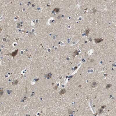 Immunohistochemistry-Paraffin: Kv7.5 Antibody [NBP1-82861]