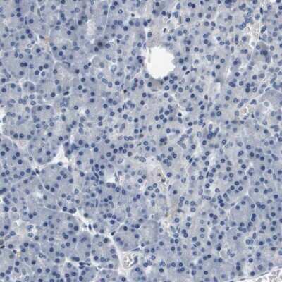 Immunohistochemistry-Paraffin: Kv7.5 Antibody [NBP1-82861]