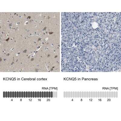 Immunohistochemistry-Paraffin: Kv7.5 Antibody [NBP1-82861]