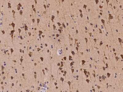 Immunohistochemistry-Paraffin: Kv7.5 Antibody [NBP2-98067]