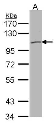 Western Blot: Kv7.5 Antibody [NBP1-32309]