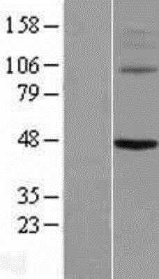 Western Blot: Kv8.1 Overexpression Lysate [NBP2-07348]