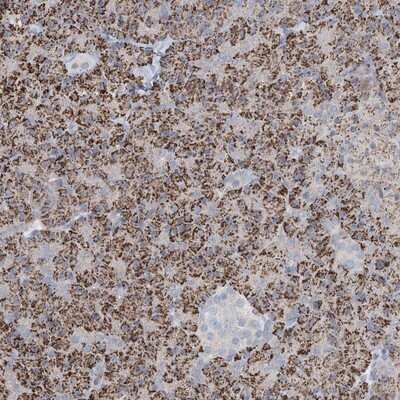 Immunohistochemistry-Paraffin: Kv8.2 Antibody [NBP1-82860]