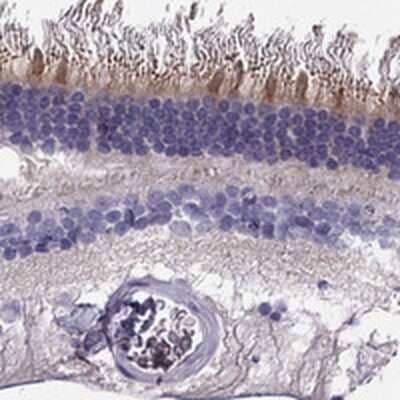 Immunohistochemistry-Paraffin: Kv8.2 Antibody [NBP1-82860]