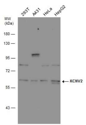 Western Blot: Kv8.2 Antibody [NBP3-12995]