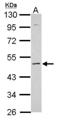 Western Blot: Kv9.2 Antibody [NBP2-19316]