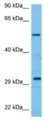 Western Blot: Kv9.2 Antibody [NBP3-10168]