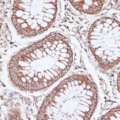 Immunohistochemistry-Paraffin: Kv9.3 Antibody - BSA Free [NBP3-03307]