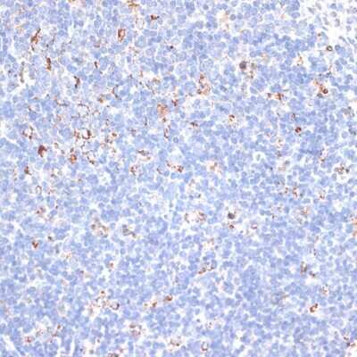 Immunohistochemistry-Paraffin: Kv9.3 Antibody - BSA Free [NBP3-03307]