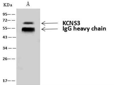 Immunoprecipitation: Kv9.3 Antibody [NBP3-05922]
