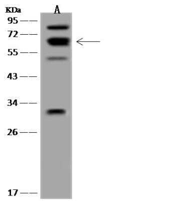 Western Blot: Kv9.3 Antibody [NBP3-05922]