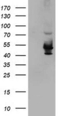 Western Blot: KvBeta1 Antibody (OTI4E7) [NBP2-01526]