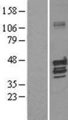 Western Blot: KvBeta1 Overexpression Lysate [NBL1-12141]