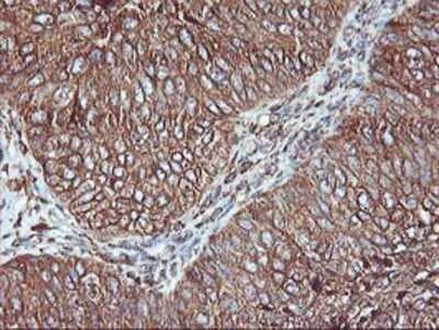 Immunohistochemistry: KvBeta1 Antibody (OTI4E7) - Azide and BSA Free [NBP2-71344]