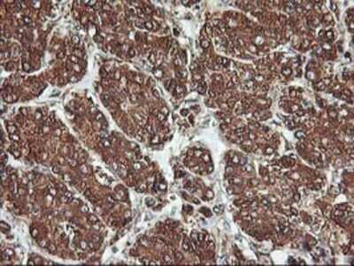 Immunohistochemistry: KvBeta1 Antibody (OTI4E7) - Azide and BSA Free [NBP2-71344]