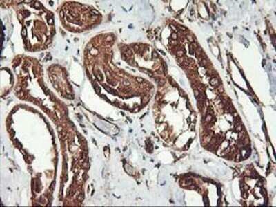 Immunohistochemistry: KvBeta1 Antibody (OTI4E7) - Azide and BSA Free [NBP2-71344]