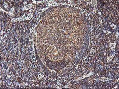 Immunohistochemistry: KvBeta1 Antibody (OTI4E7) - Azide and BSA Free [NBP2-71344]