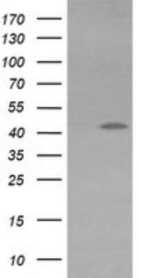 Western Blot: KvBeta1 Antibody (OTI7F12)Azide and BSA Free [NBP2-71349]