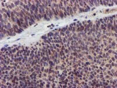 Immunohistochemistry: KvBeta1 Antibody (OTI7F12) [NBP2-45767]