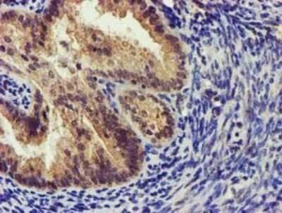 Immunohistochemistry: KvBeta1 Antibody (OTI7F12) [NBP2-45767]