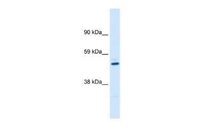 Western Blot: KvBeta1 Antibody [NBP2-86698]